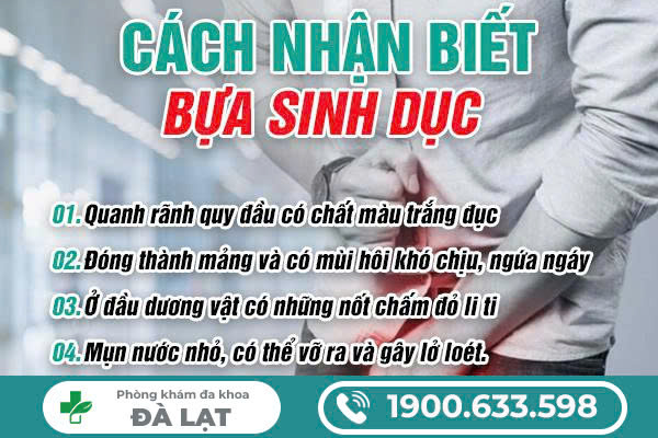 Hình ảnh minh họa